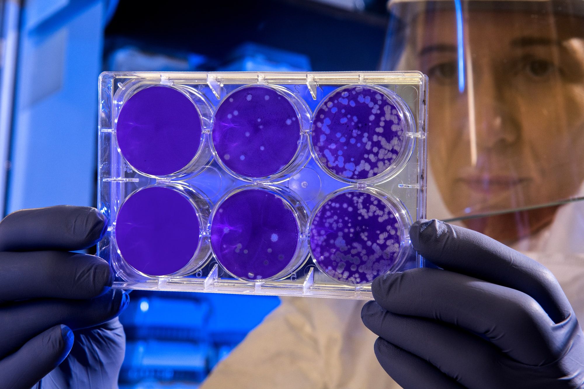 Scientist examines the result of a plaque assay, which is a test that allows scientists to count how many flu virus particles (virions) are in a mixture. To perform the test, scientists must first grow host cells that attach to the bottom of the plate, and then add viruses to each well so that the attached cells may be infected. After staining the uninfected cells purple, the scientist can count the clear spots on the plate, each representing a single virus particle.